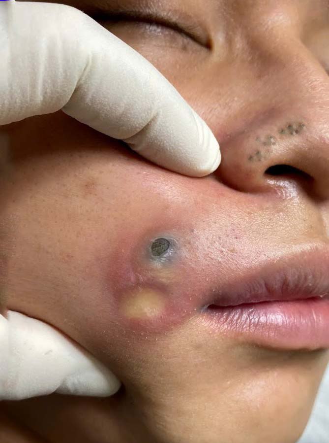 Bride of Frankenstein