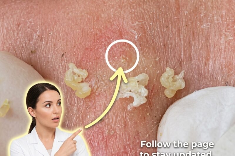 How Chronic Inflammation Alters Skin Texture and the Role of Ingredient Interactions