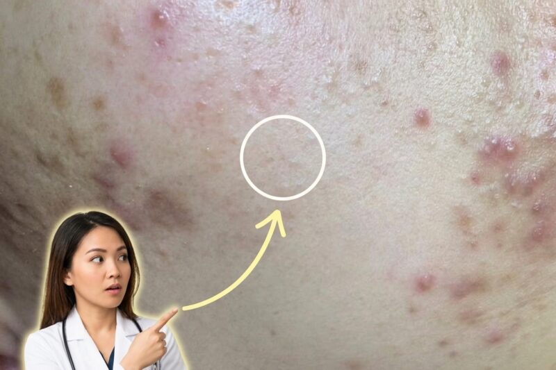 Managing Hormonal Breakouts: How Skincare Active Ingredients Interact With Cycle-Driven Skin Changes