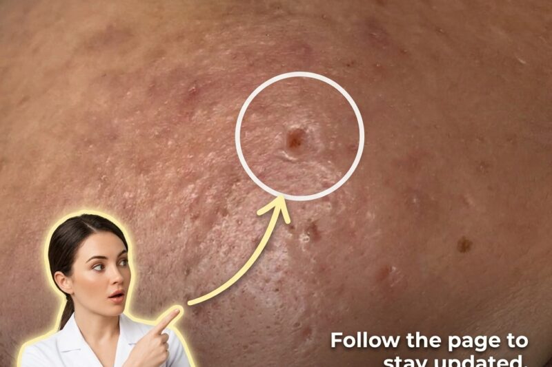Understanding the Role of Cellular Shedding in Pore Congestion and Long-Term Skin Health